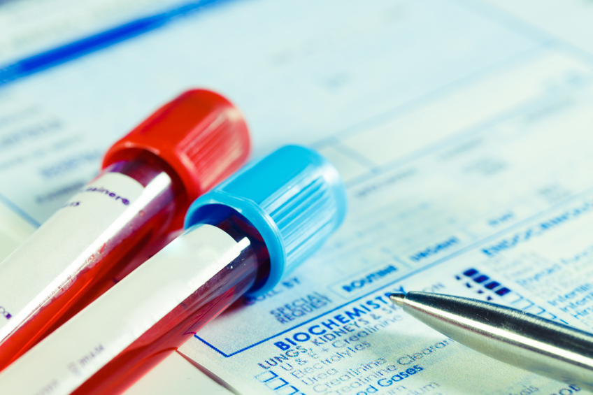 Biochemistry blood tests